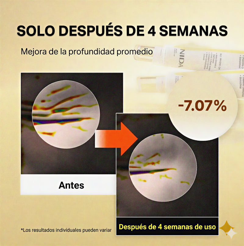3. Restaura el "Rebote" de Tu Piel